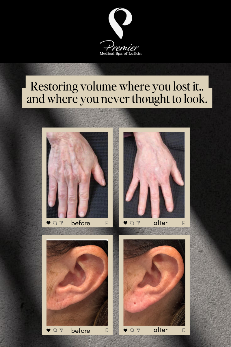 Ear Lobe + Hand Filler Promo