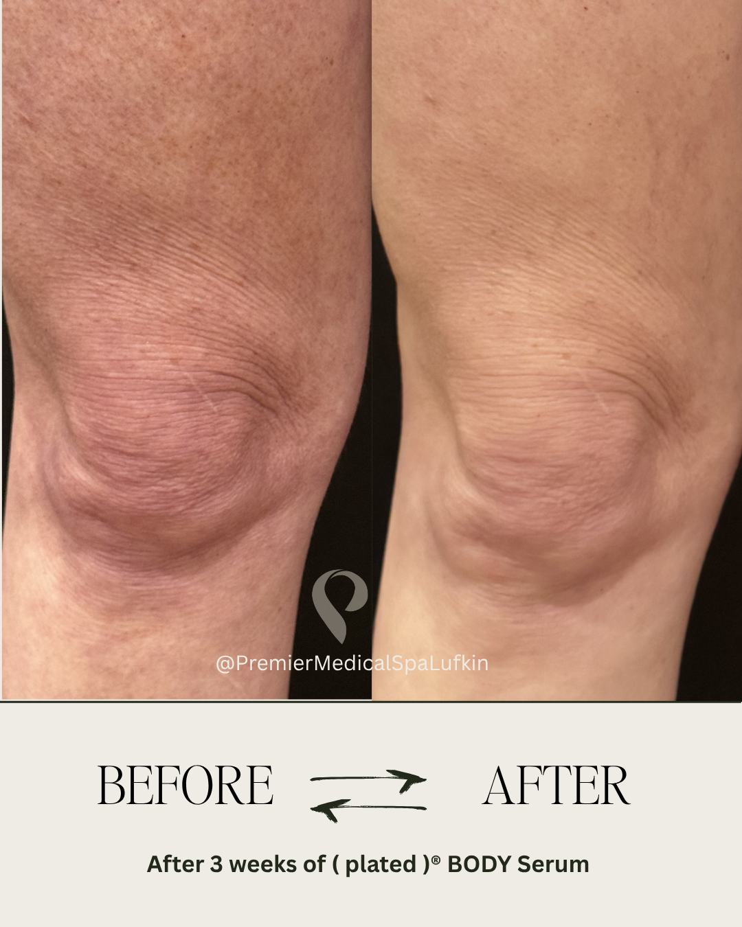 Plated Body Serum **PRE-ORDER**